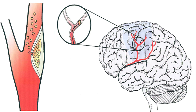 Best vascular surgeon in Egypt